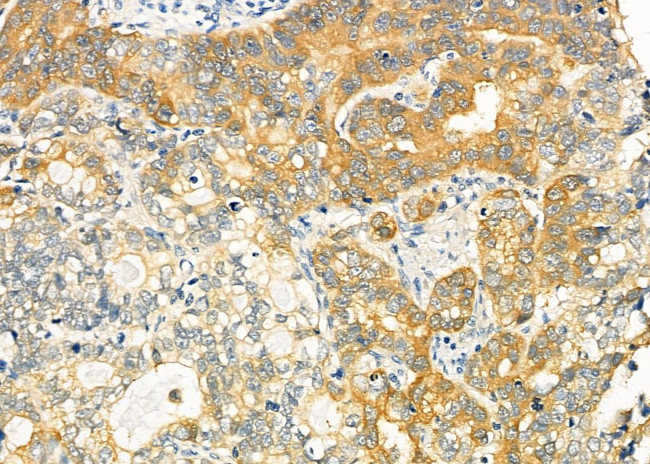 MGRN1 Antibody in Immunohistochemistry (Paraffin) (IHC (P))