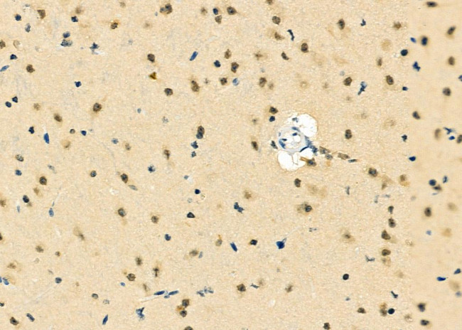 MGRN1 Antibody in Immunohistochemistry (Paraffin) (IHC (P))