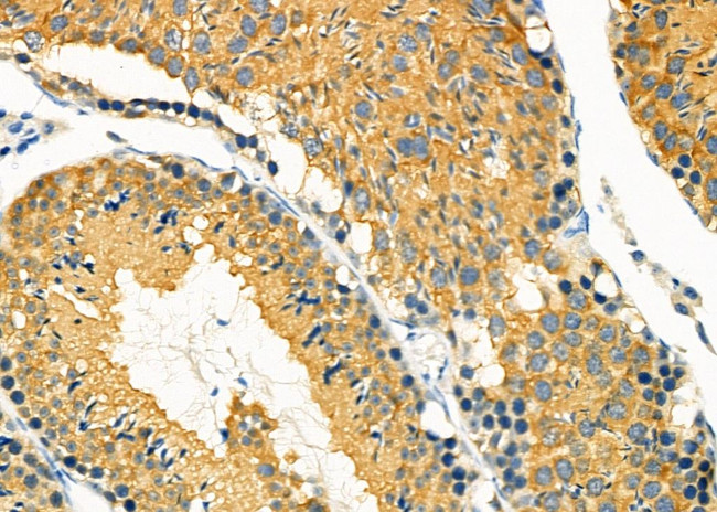 MGRN1 Antibody in Immunohistochemistry (Paraffin) (IHC (P))