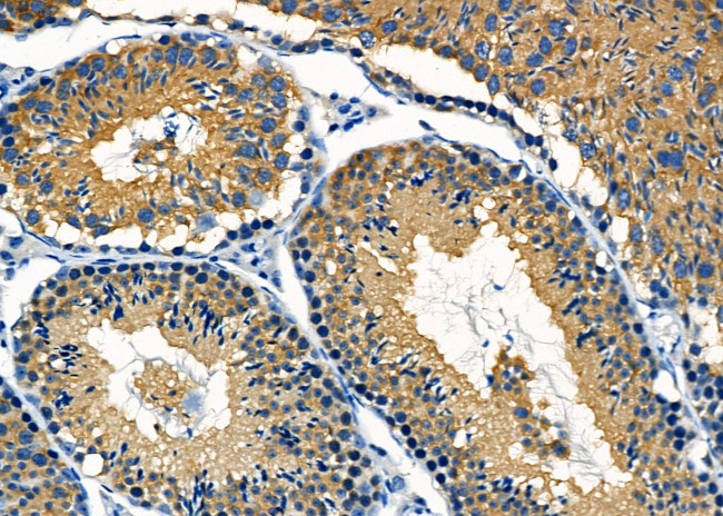 MGRN1 Antibody in Immunohistochemistry (Paraffin) (IHC (P))