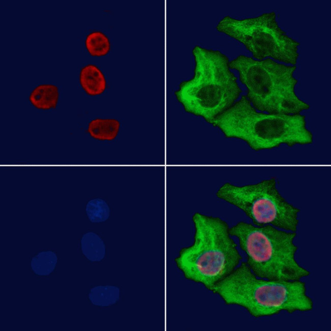 SFPQ Antibody in Immunocytochemistry (ICC/IF)