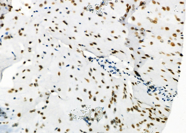 SFPQ Antibody in Immunohistochemistry (Paraffin) (IHC (P))