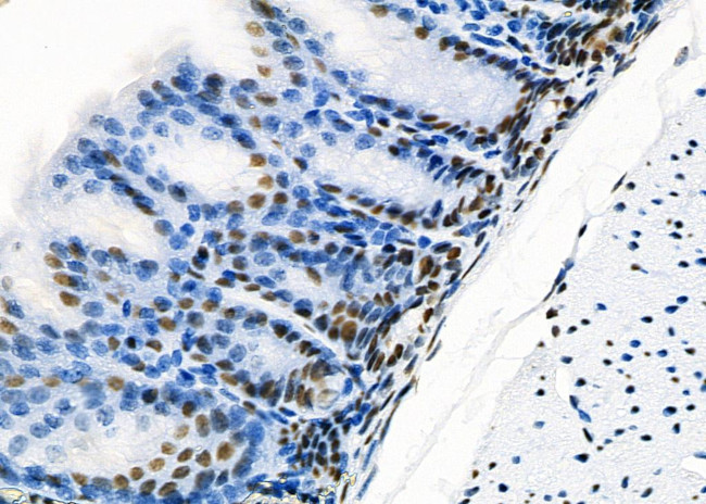 SFPQ Antibody in Immunohistochemistry (Paraffin) (IHC (P))