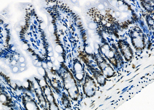 SFPQ Antibody in Immunohistochemistry (Paraffin) (IHC (P))