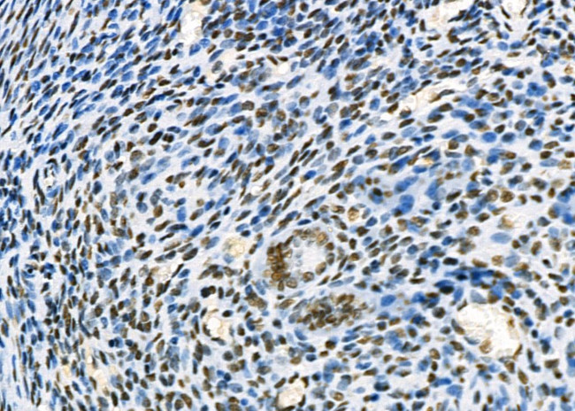 SFPQ Antibody in Immunohistochemistry (Paraffin) (IHC (P))