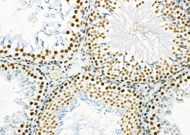 SFPQ Antibody in Immunohistochemistry (Paraffin) (IHC (P))