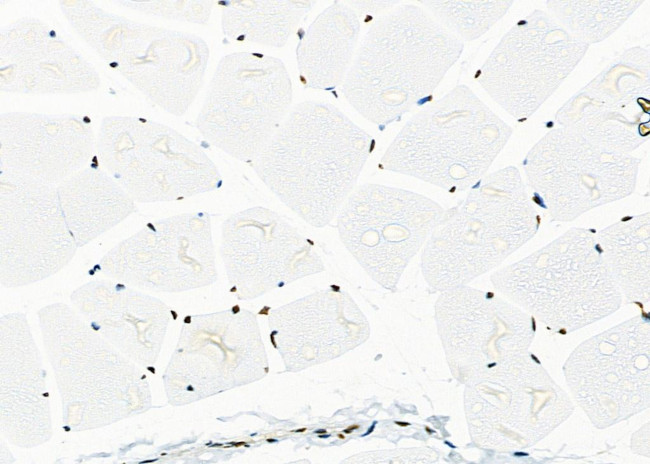 SFPQ Antibody in Immunohistochemistry (Paraffin) (IHC (P))