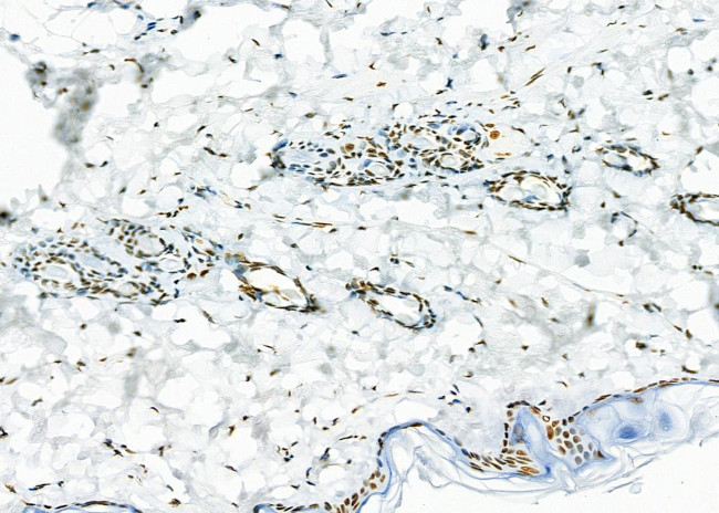 SFPQ Antibody in Immunohistochemistry (Paraffin) (IHC (P))