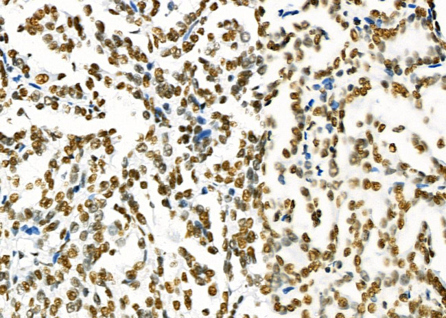 SFPQ Antibody in Immunohistochemistry (Paraffin) (IHC (P))