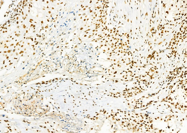 SFPQ Antibody in Immunohistochemistry (Paraffin) (IHC (P))