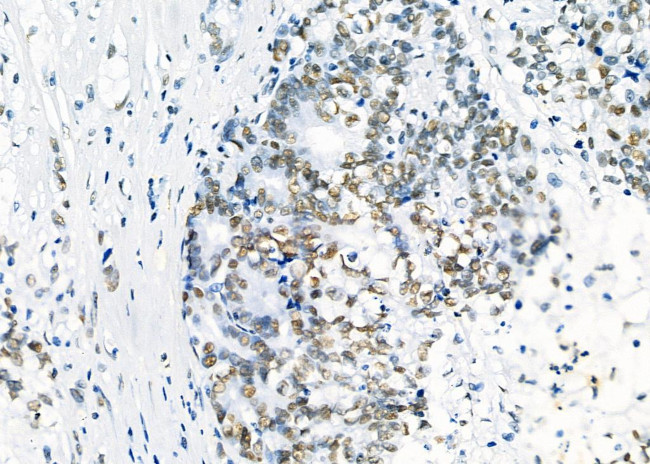 SFPQ Antibody in Immunohistochemistry (Paraffin) (IHC (P))