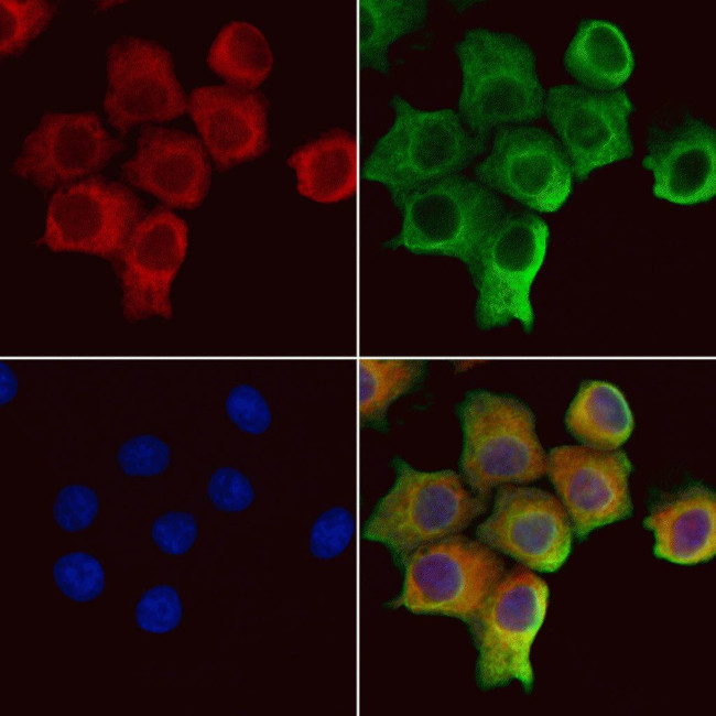 SRP14 Antibody in Immunocytochemistry (ICC/IF)