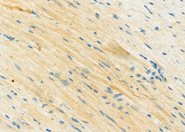 STBD1 Antibody in Immunohistochemistry (Paraffin) (IHC (P))