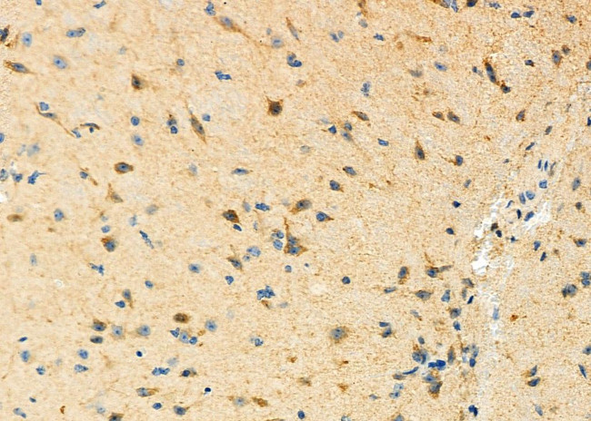 STBD1 Antibody in Immunohistochemistry (Paraffin) (IHC (P))