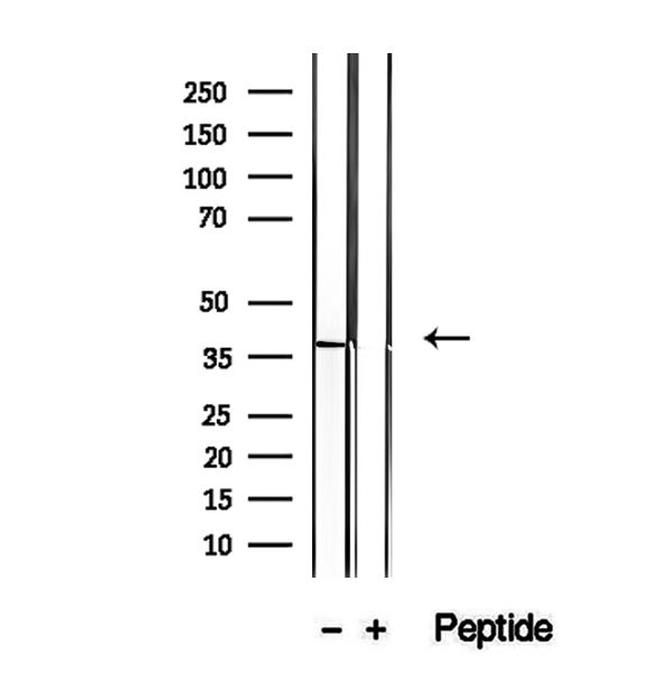 STBD1 Antibody in Western Blot (WB)