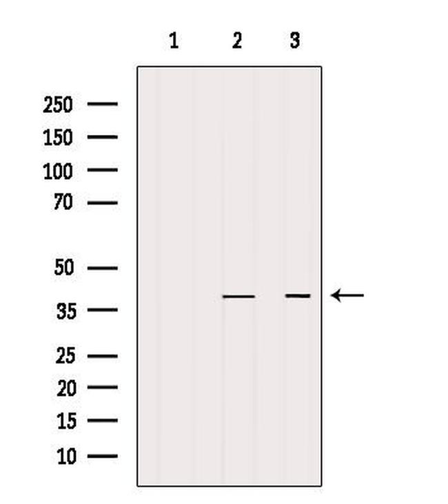 STBD1 Antibody in Western Blot (WB)