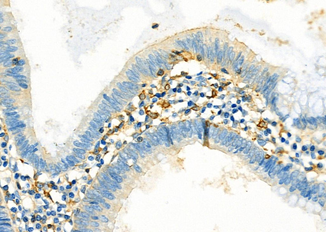 SULT1C2 Antibody in Immunohistochemistry (Paraffin) (IHC (P))