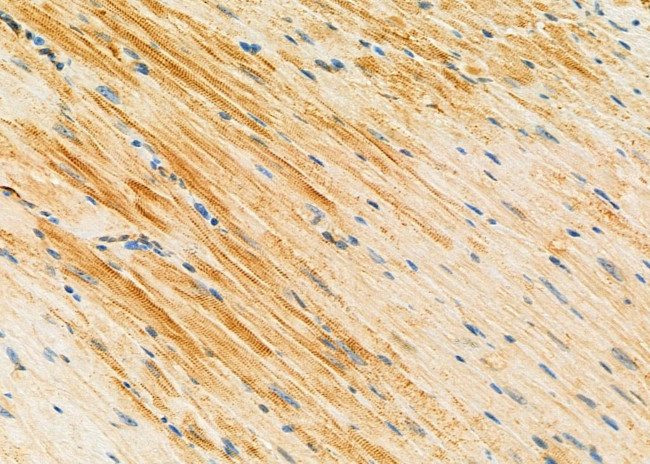 SULT1C2 Antibody in Immunohistochemistry (Paraffin) (IHC (P))