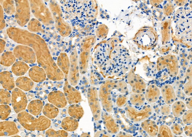 SULT1C2 Antibody in Immunohistochemistry (Paraffin) (IHC (P))