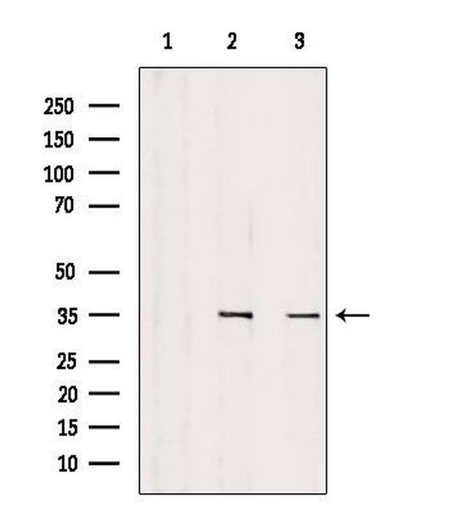 SULT1C2 Antibody in Western Blot (WB)