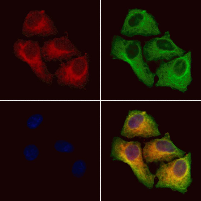 TMOD1 Antibody in Immunocytochemistry (ICC/IF)