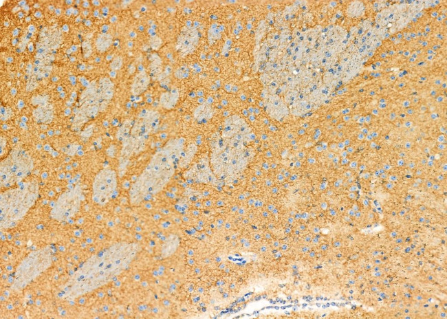 TMOD1 Antibody in Immunohistochemistry (Paraffin) (IHC (P))