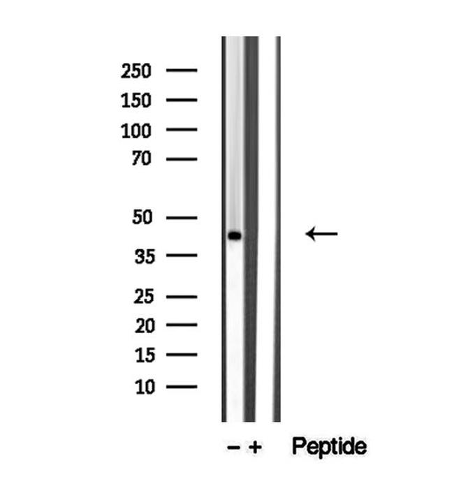 TMOD1 Antibody in Western Blot (WB)