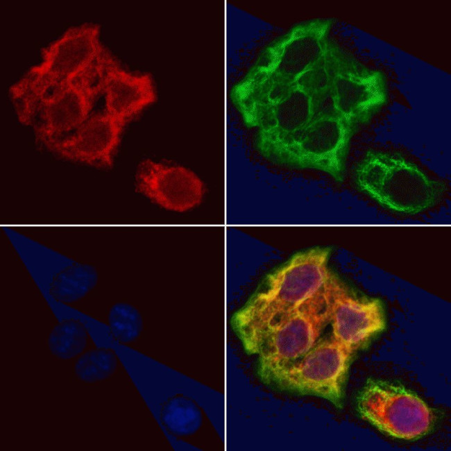 TMSB4X Antibody in Immunocytochemistry (ICC/IF)