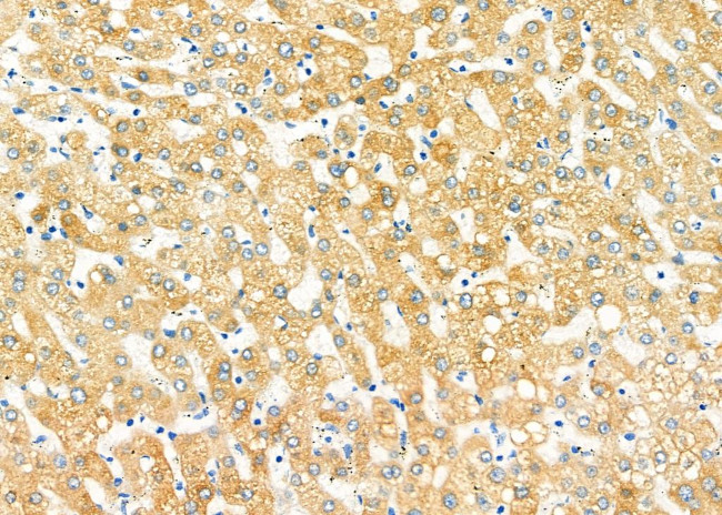 TMSB4X Antibody in Immunohistochemistry (Paraffin) (IHC (P))