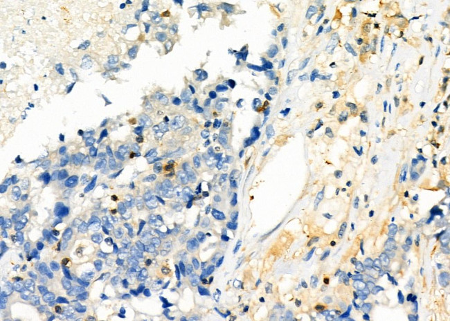 TMSB4X Antibody in Immunohistochemistry (Paraffin) (IHC (P))