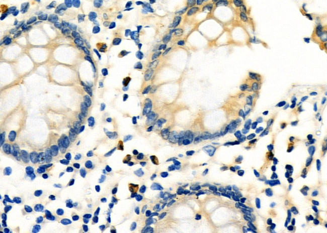 TMSB4X Antibody in Immunohistochemistry (Paraffin) (IHC (P))