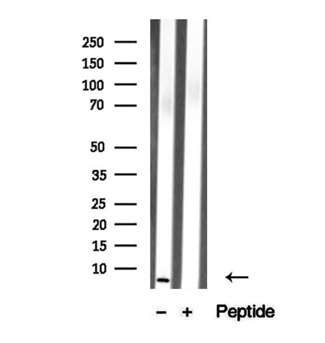 TMSB4X Antibody in Western Blot (WB)