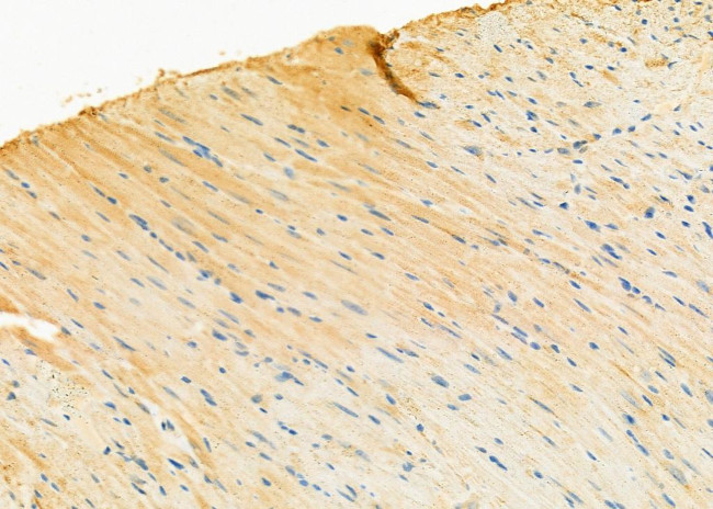 UQCRC1 Antibody in Immunohistochemistry (Paraffin) (IHC (P))