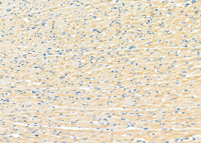 UQCRC1 Antibody in Immunohistochemistry (Paraffin) (IHC (P))