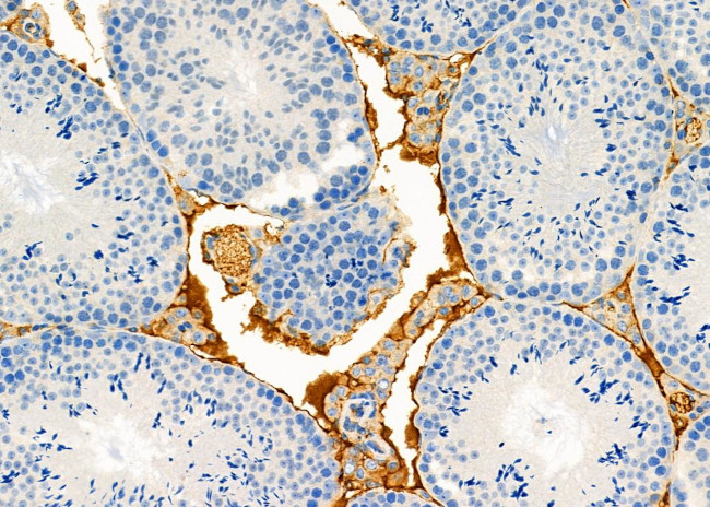 BAMBI Antibody in Immunohistochemistry (Paraffin) (IHC (P))