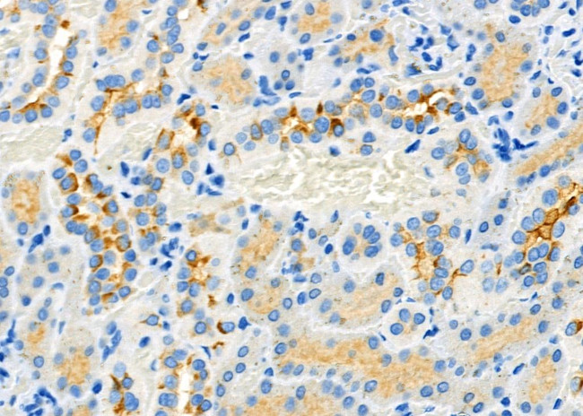 BAMBI Antibody in Immunohistochemistry (Paraffin) (IHC (P))