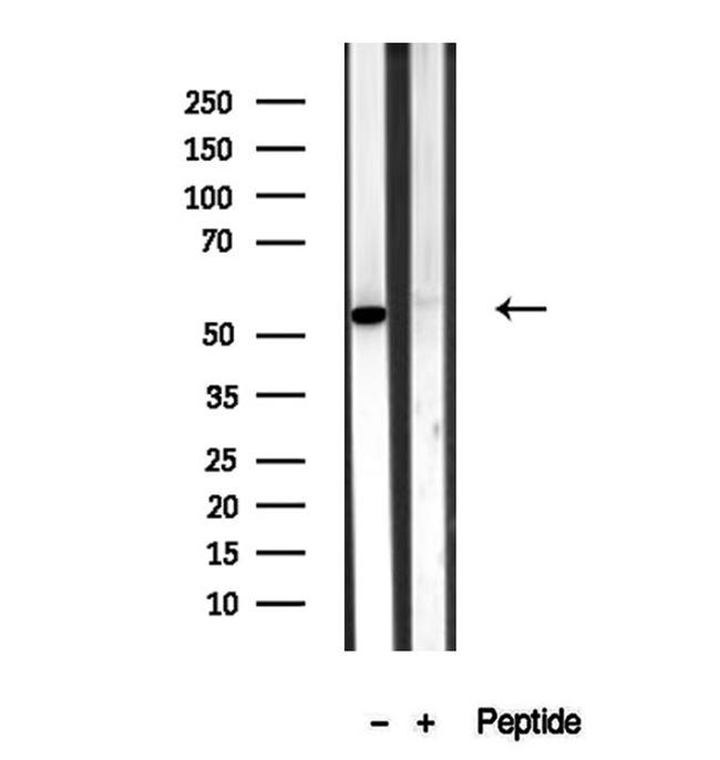 BAMBI Antibody in Western Blot (WB)