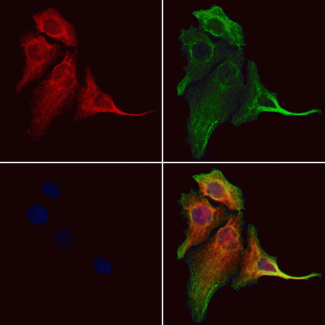 CALCOCO2 Antibody in Immunocytochemistry (ICC/IF)