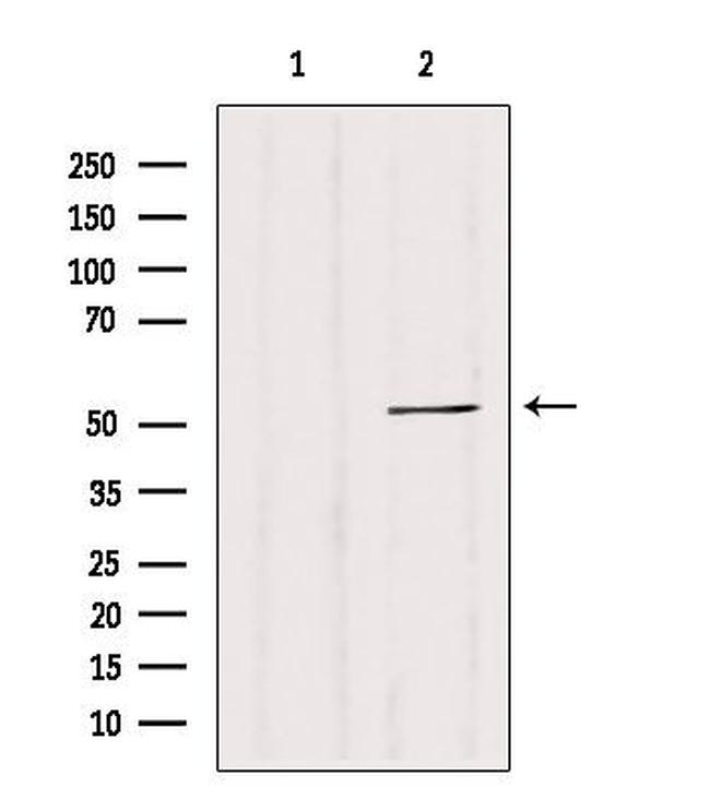 CALCOCO2 Antibody in Western Blot (WB)