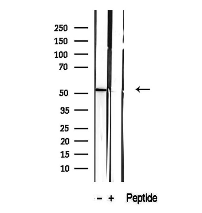 CALCOCO2 Antibody in Western Blot (WB)