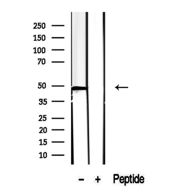 CCBL1 Antibody in Western Blot (WB)