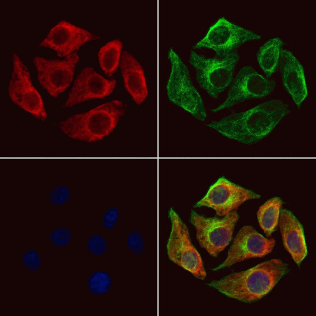 SH3KBP1 Antibody in Immunocytochemistry (ICC/IF)