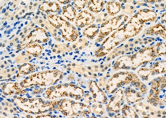 SH3KBP1 Antibody in Immunohistochemistry (Paraffin) (IHC (P))