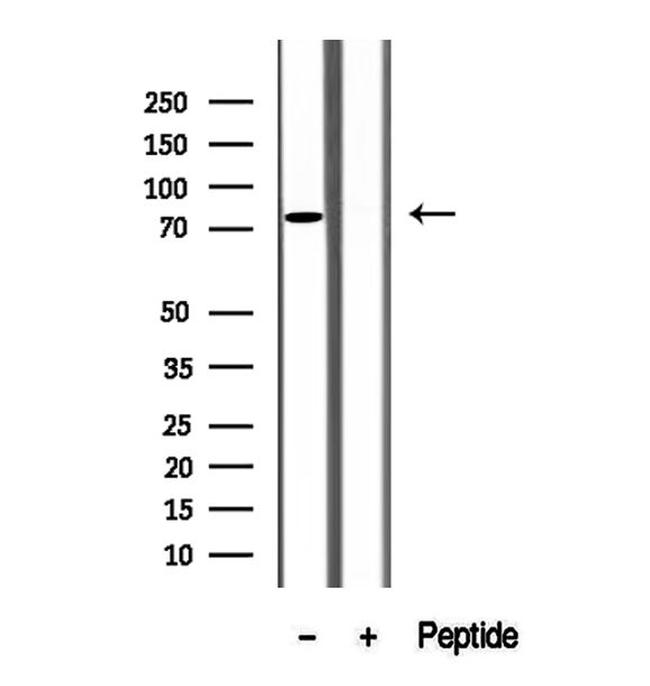 SH3KBP1 Antibody in Western Blot (WB)