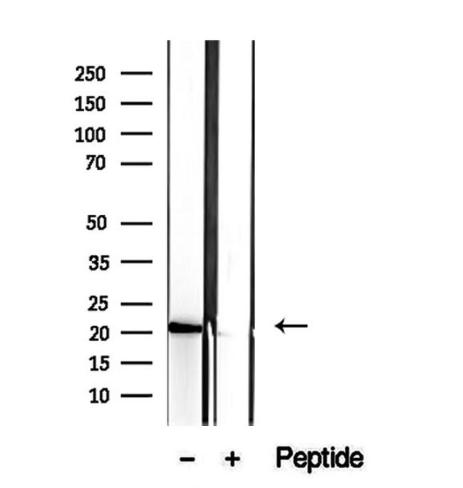 CNPY2 Antibody in Western Blot (WB)