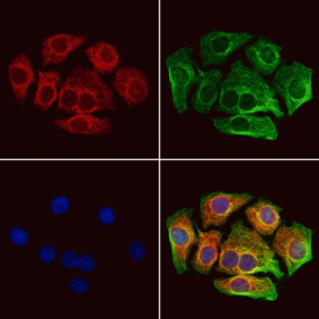 CAT1 Antibody in Immunocytochemistry (ICC/IF)