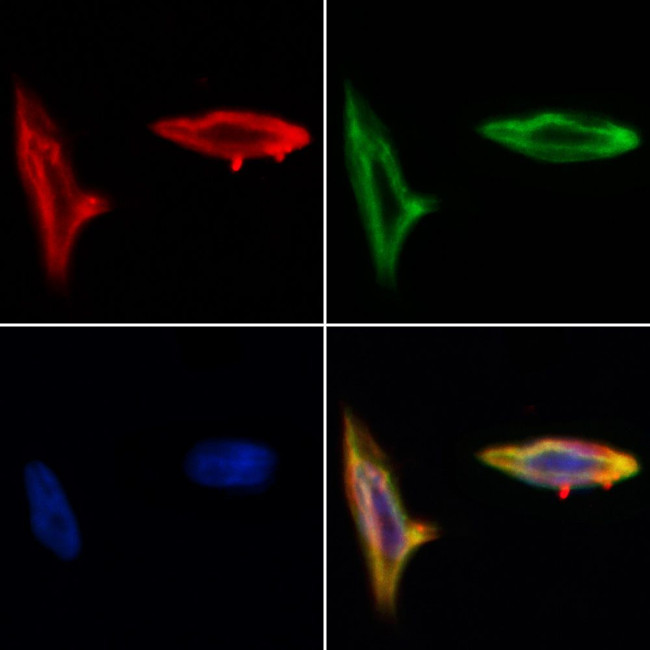 CAT1 Antibody in Immunocytochemistry (ICC/IF)