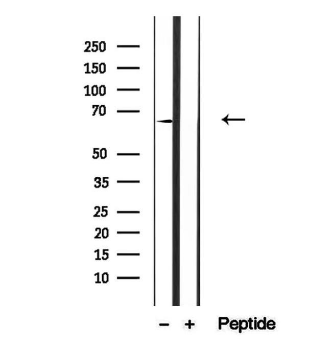 CAT1 Antibody in Western Blot (WB)