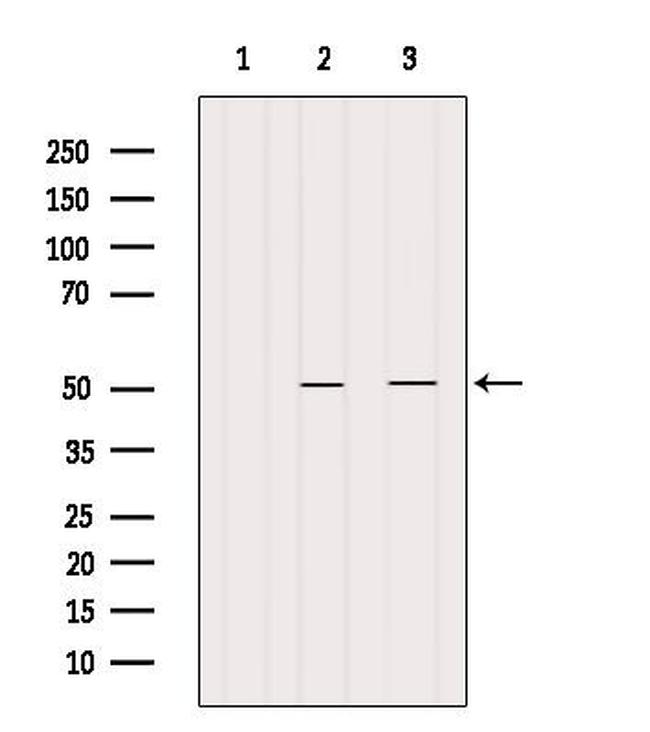 CRLS1 Antibody in Western Blot (WB)