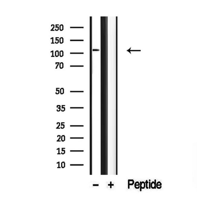 DAAM1 Antibody in Western Blot (WB)